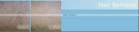 Home IPL Epilator for hair removal A005