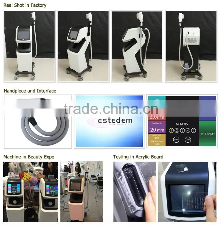 New product 2015 high intensity focused ultrasound HIFU OD-H6