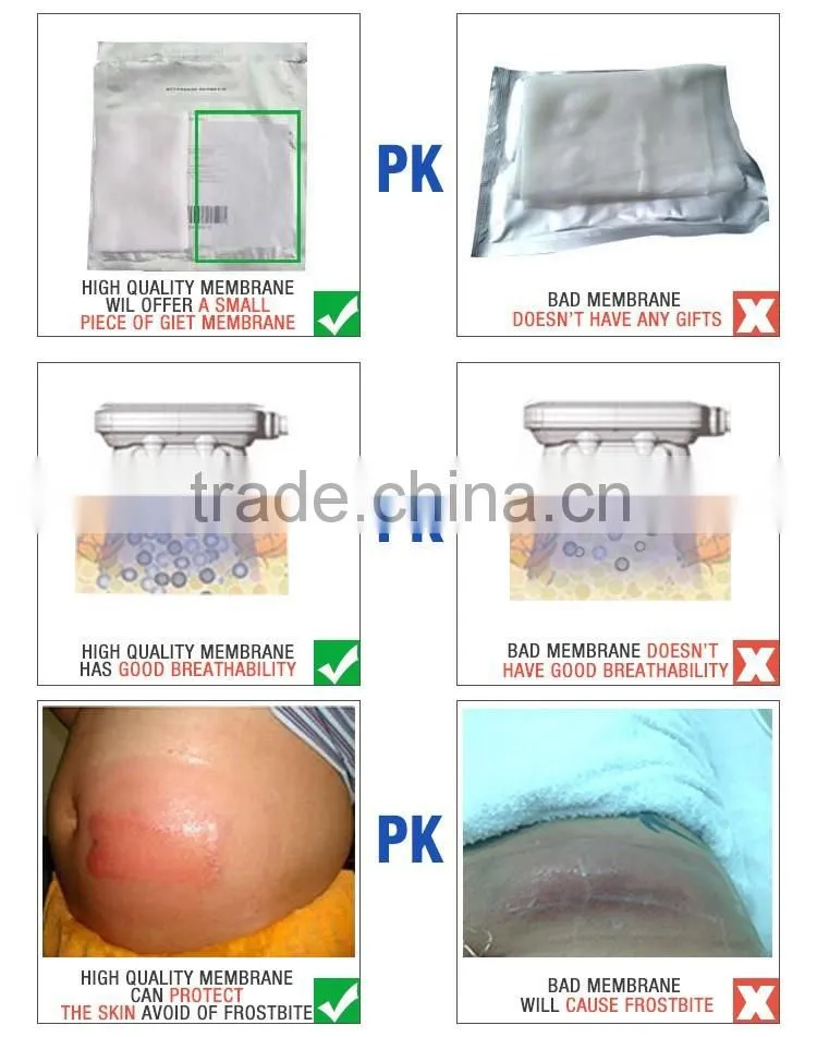 freezefat anti-freezing membrane/ freezefat membrane / anti freezing membrance