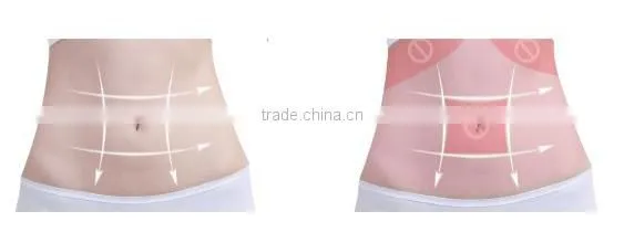 2017 Hot sale portable liposonix Body slimming machine weight Loss machine for home use