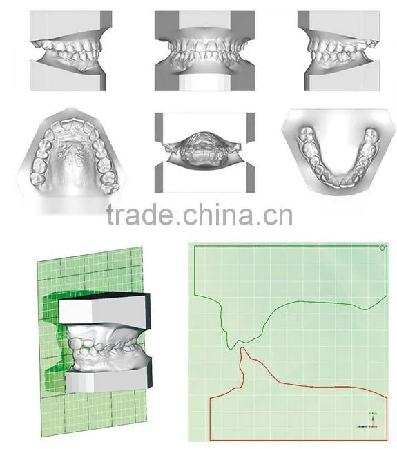 Digital 3D Intra-oral imaging X-ray machine