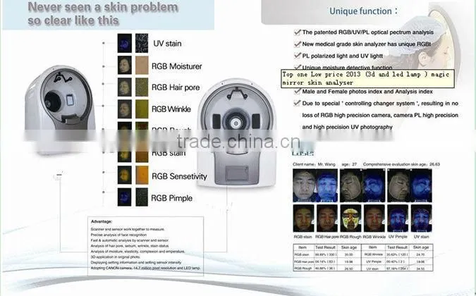 Best portable medical woods lamp skin analyzer