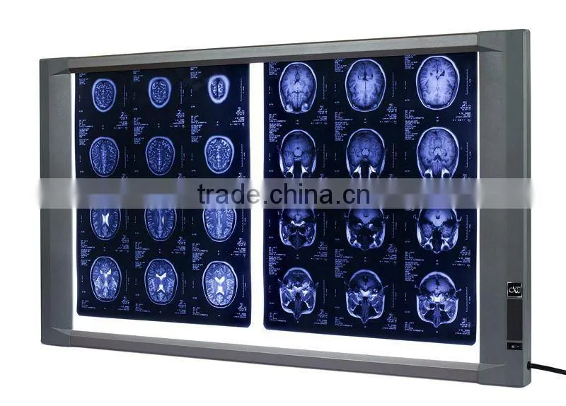 Ultra slim medical xray film viewer