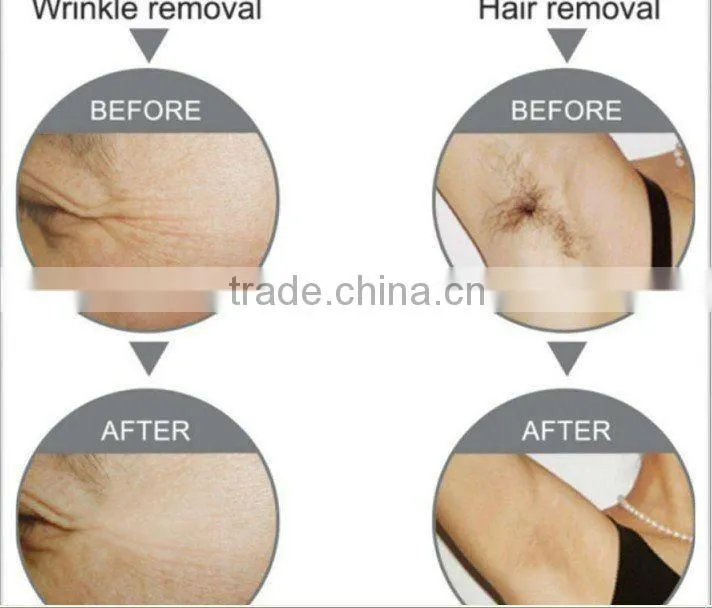 HOT!!!Vertical ipl beauty hair removal machine C006 favourite price