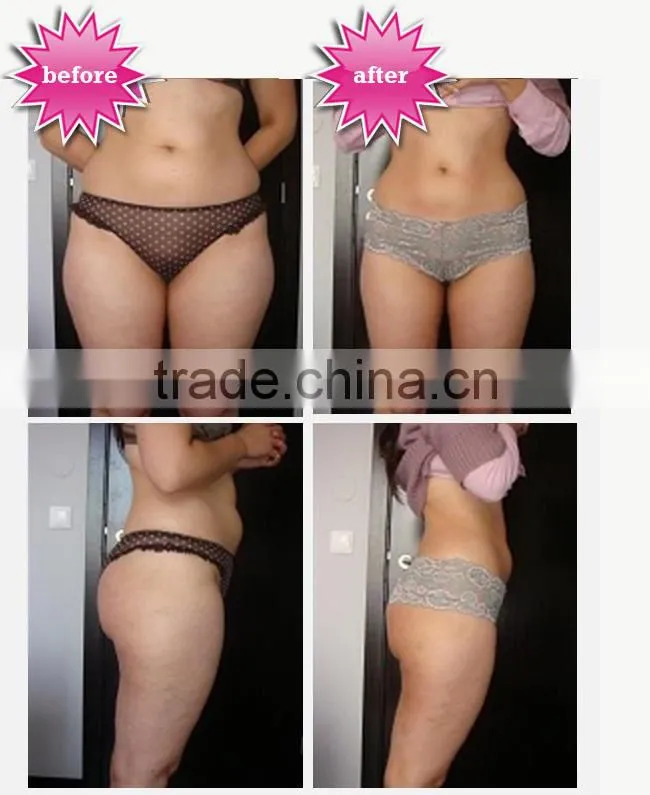 Pressotherapy-infrared slimming machine