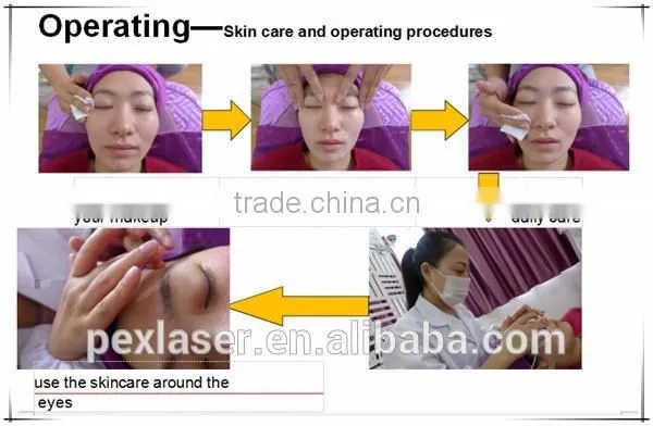 Eye Wrinkle Treatment RF eye lift machine