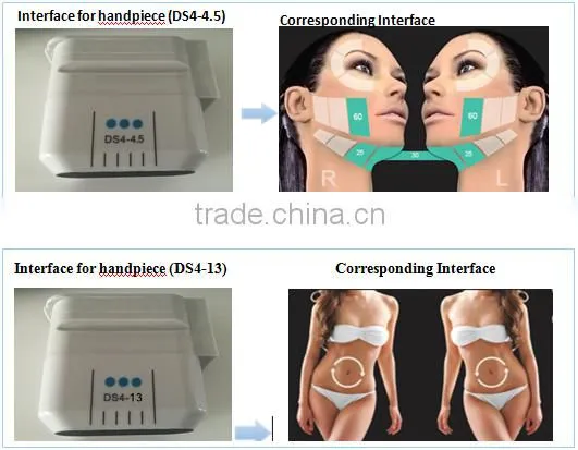 2016 Obvious result slimming machine hifu body shaping