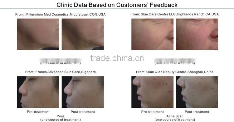 Non Invasive Multi-function Anti-aging Beauty Machine