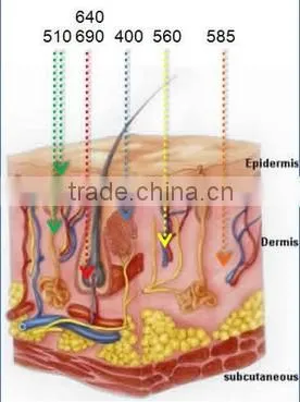 promotion shr hair removal hair removal ipl machine