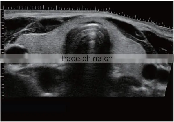 CE ISO approved medical 15 inch LCD Monitor 3D 4D trolley color doppler ultrasound scanner