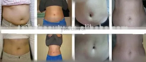 high tech rf cavitation body slimming machine/laser cavitation rf vacuum cavitation slimming/fat removal focused ultrasonic