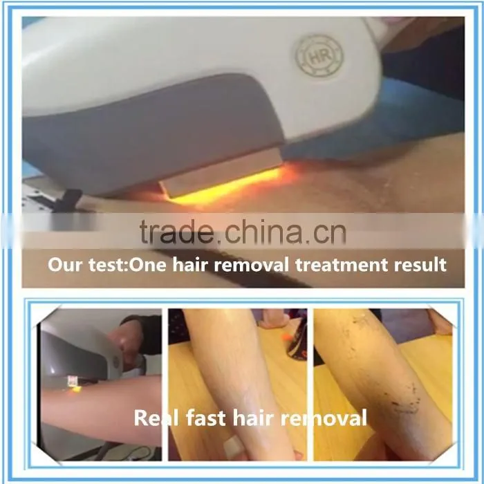 medical ce approved permanent Hair Remove device SHR hair removal IPL