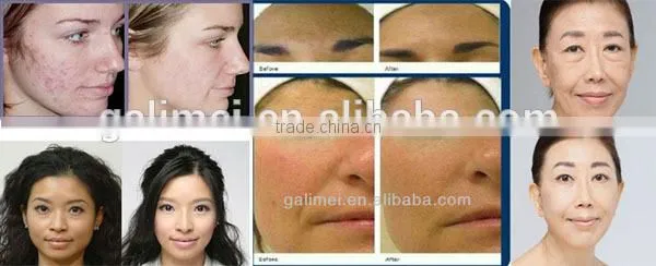 Professional 2 in 1 pdt bio photon light therapy salon equipment for skin care