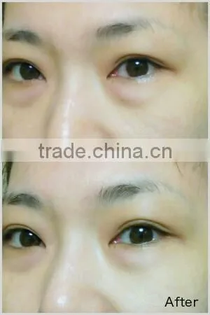 japanese product, Japanese high quality CO2 gel face mask for skin care