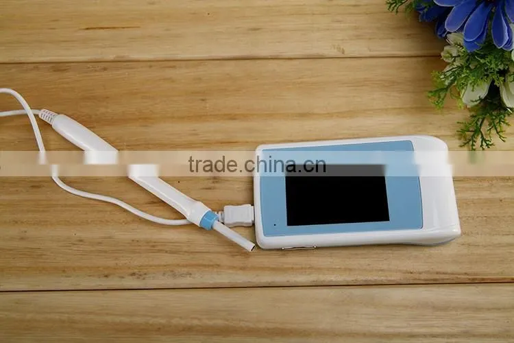 China Low price1.3MP Best Dental Cameras With Monitor for 2016