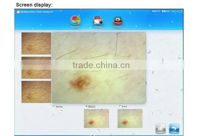AYJ-J016 skin ance blackhead wrinkle microscope