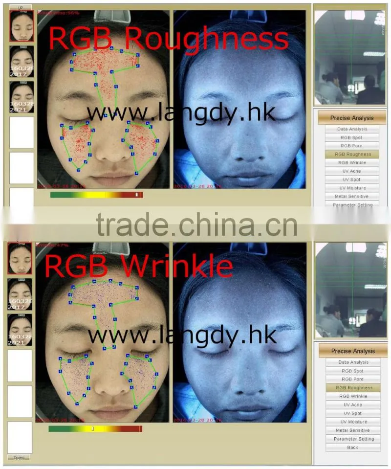 The exhibition hot sell facial detection machine