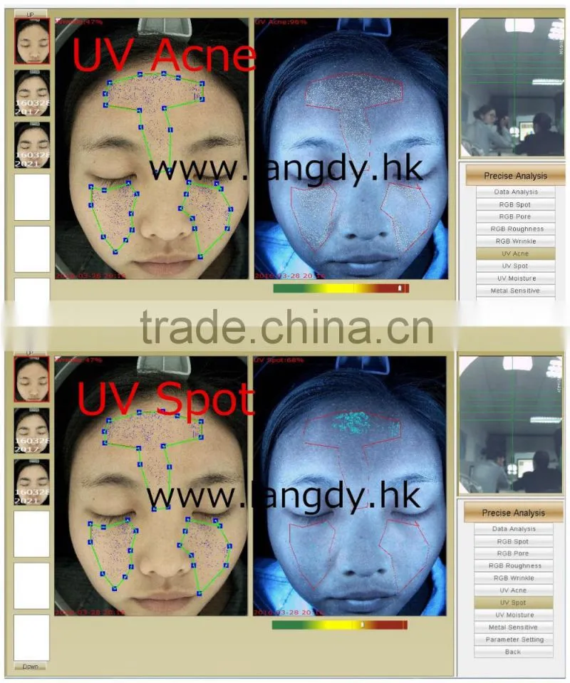 computer software skin analysis system acne wrinkle spot pore analyzer device