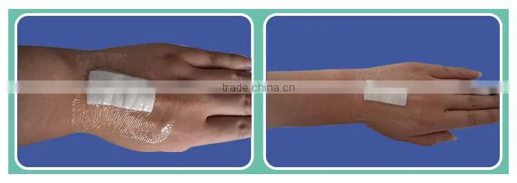 medical frame dressing in hospital with CE FDA ISO13485