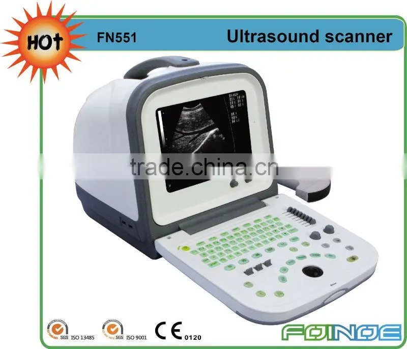FN551 HOT selling CE approved full digital ultrasound scanner price