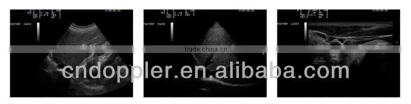 Doppler Medical Ultrasound transducer