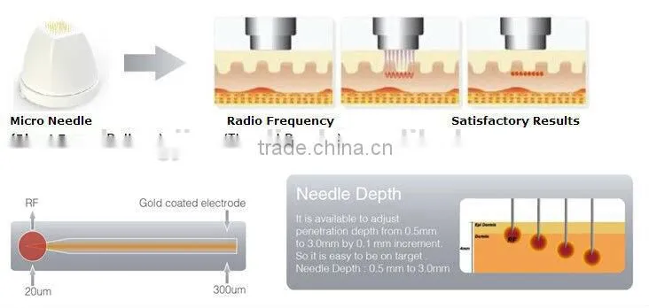 RF laser facial machine/face lifting and tightening equipment