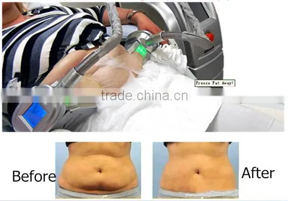 2016 CE certification cool tech cryo shaping for body fat reduction