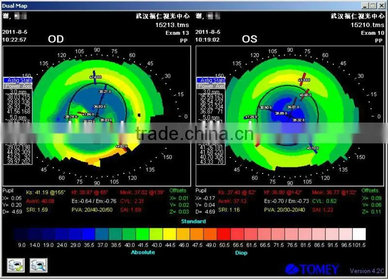 High-technology Mild MCT ,fpr myopia and amblyopia China