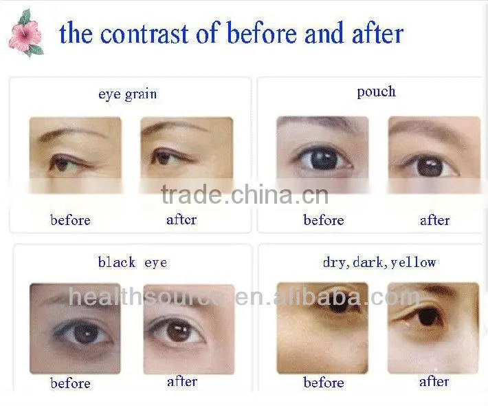 red wine anti wrinkle eye pads