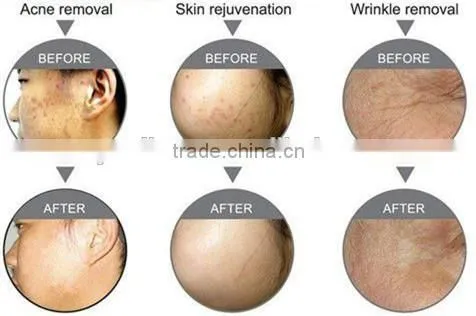 Professional Pdt Led Light Therapy Facial Care Salon Equipment 7 Colors