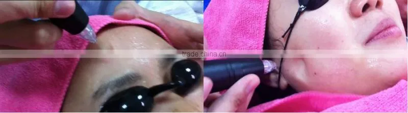 2016 hot selling spa water oxygen jet peel anti-aging facial treatment machine for sale