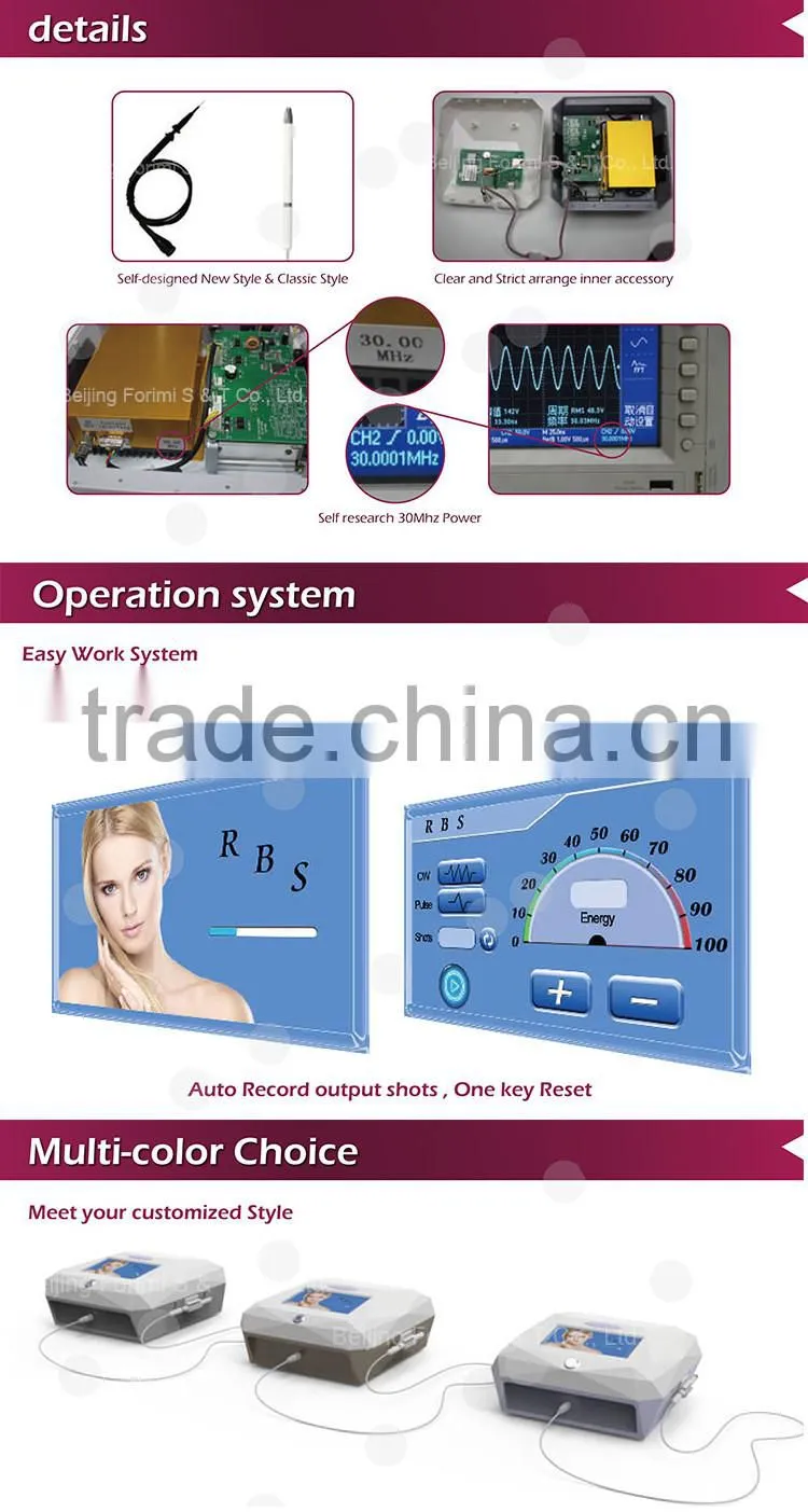 Distributor low price blood vessels removal spider veins treatment for pigmented lesion