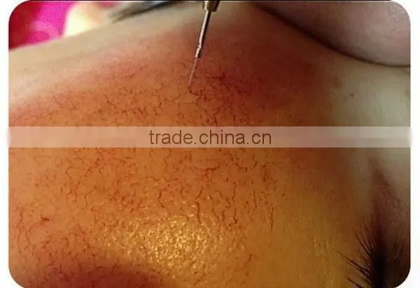Salon use Acne treatment and Face clean machine RBS