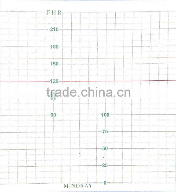 Fetal Monitor Paper / 112mm*100mm-150p Fetal Monitor Recording Paper for Mindray