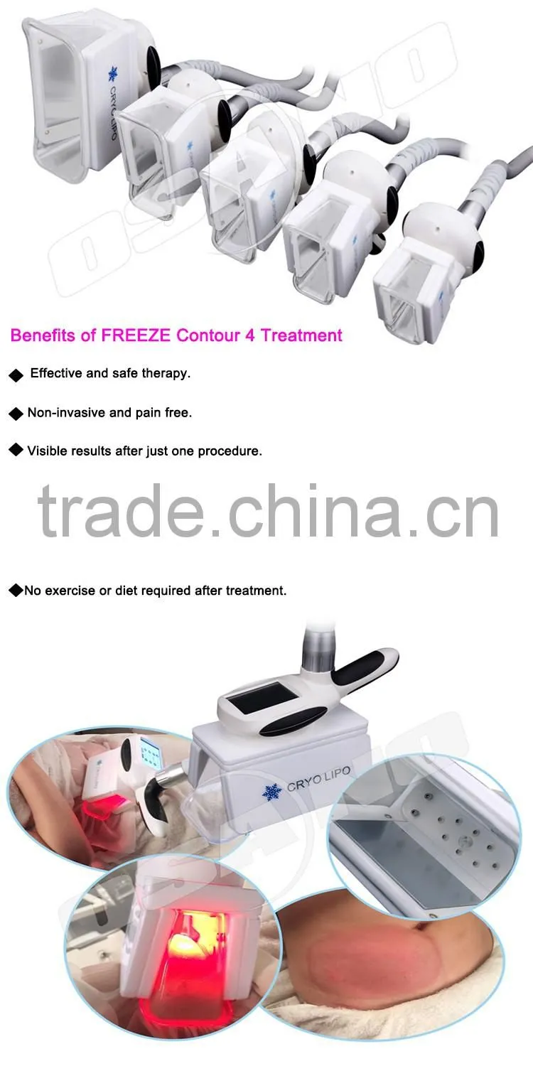 kryolipolysis 3 Handles Cryo Therapy Fat Freeze Machine