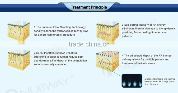2016 fractional rf needle/Fractional RF micro-needle mesotherapy