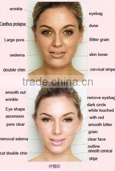 facial exercise machines for home use tm-270