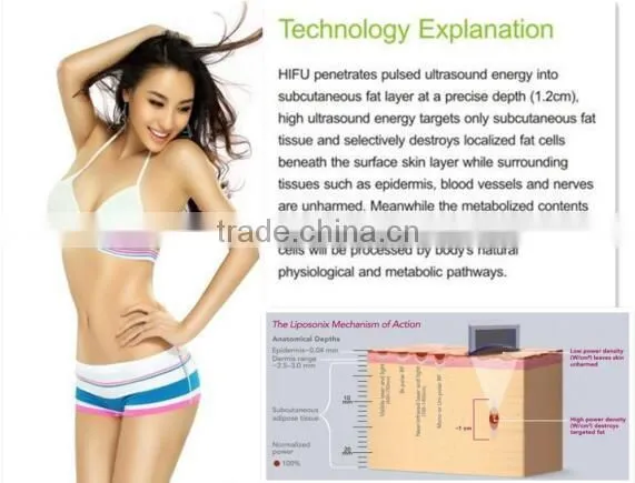 LS08-laura trending hot beauty products body slimming hifu ultrashape liposonix machine