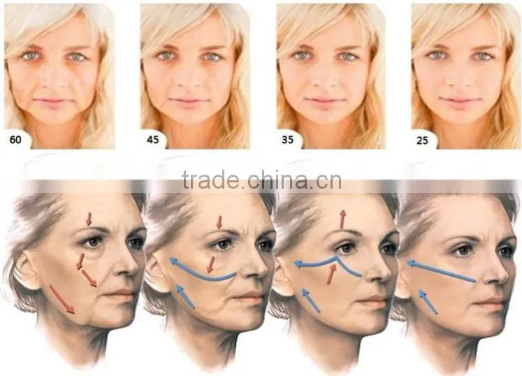 The factory price skin tightening machine skin care hifu hifu high intensity focused ultrasound HIFU in china