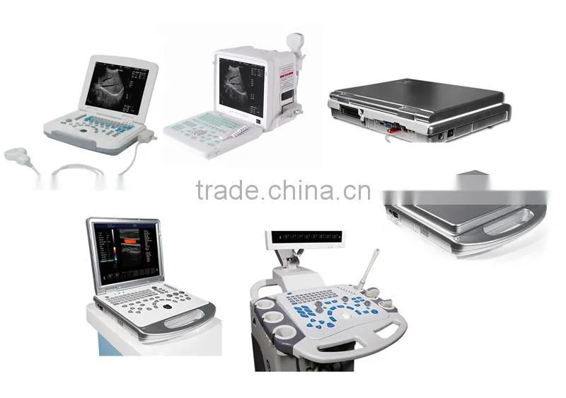 ultrasound machine ,ultrasound machine price,ultrasound scanner