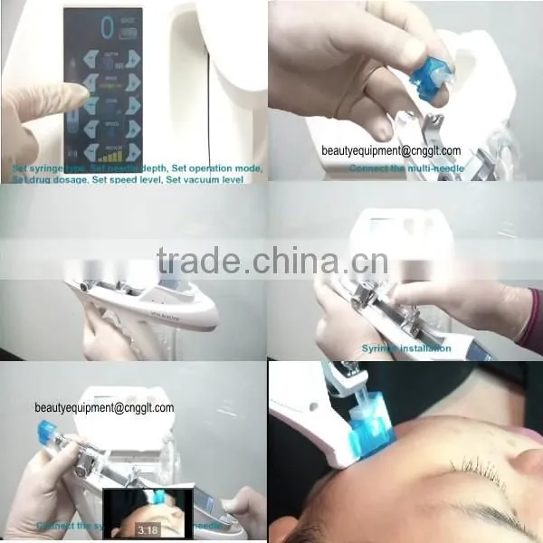 Professional Mesogun Injector for Hair Pore Shrink and Neck Wrinkle Improvement