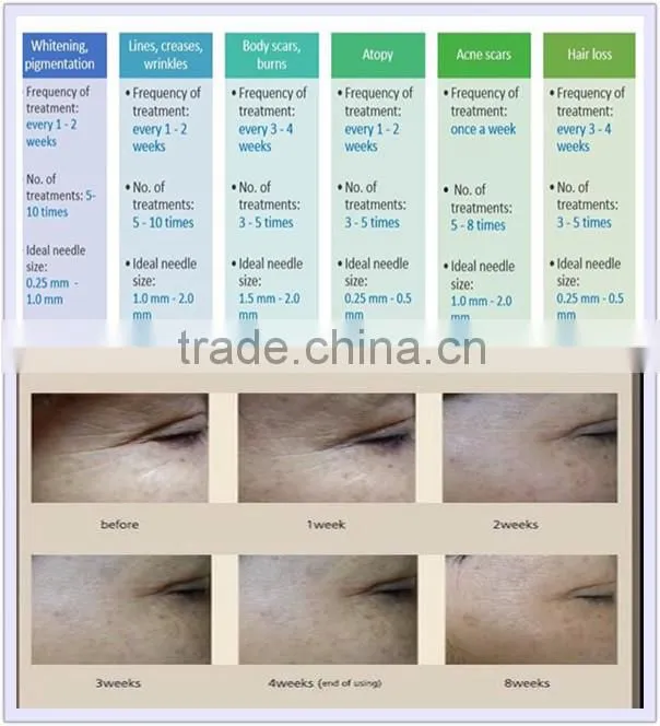 High quality DRS 192 stainless steel dermaroller eye skin care