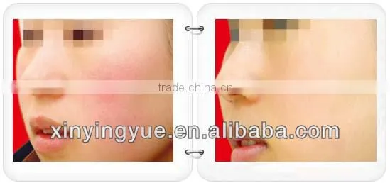 Newest Protable SHR 2 handles Hair Removal OPT IPL RF Facial Whitening