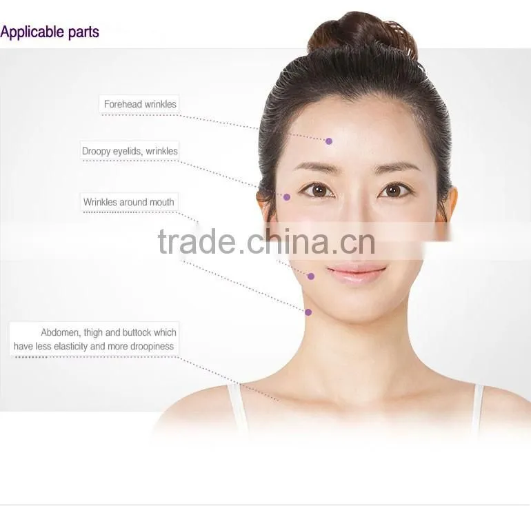 China top ten selling products soft fractional rf my orders with alibaba