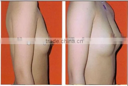 breast enhancement products breast nipple enhancer tm-505