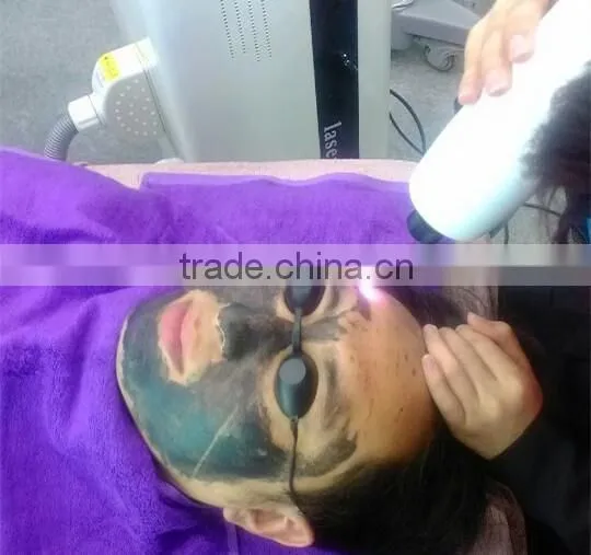 50g Carbon Skin whitening bleaching cream working with Nd Yag Laser Machine