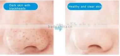Best cleansing Product Facial cleansing brush For beauty care