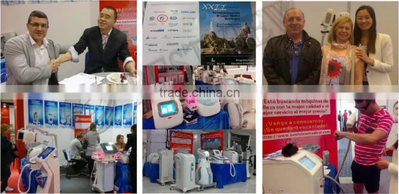 Bestview factory supply Tattoo Removal Equipment q-switch nd yag laser