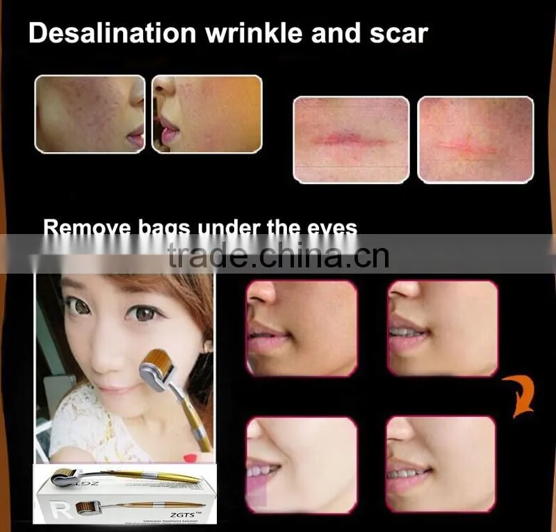 2017 Derma Pen Needles Derma Roller 192 Needles Roller Microneedle Titanium dermaroller factory price