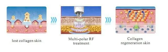 Beauty Salon Equipment High Quality ultrasonic cavitation machine price Beauty Device